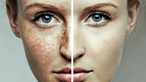 Осветляющие маски для лица от пигментных пятен. Показания и противопоказания