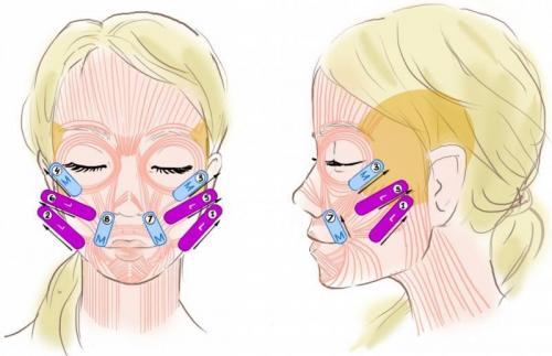 Как подтянуть овал лица посл.  Спасение от старения: способы, которые помогут подтянуть овал лица после 50 лет