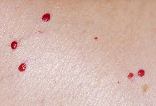 Возрастная кожа. возрастные изменения и 15 болезней кожи