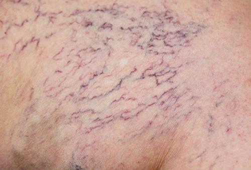 Возрастная кожа. возрастные изменения и 15 болезней кожи