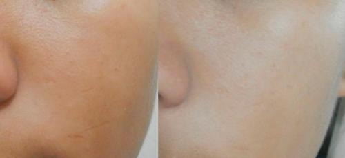 Маски отбеливающие кожу лица. Самые популярные ингредиенты масок, обладающие осветляющими качествами