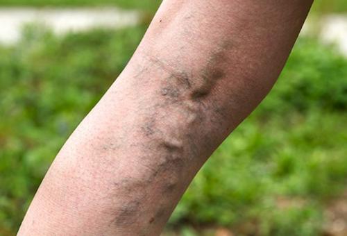 Возрастная кожа. возрастные изменения и 15 болезней кожи