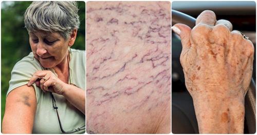 Возрастная кожа. возрастные изменения и 15 болезней кожи