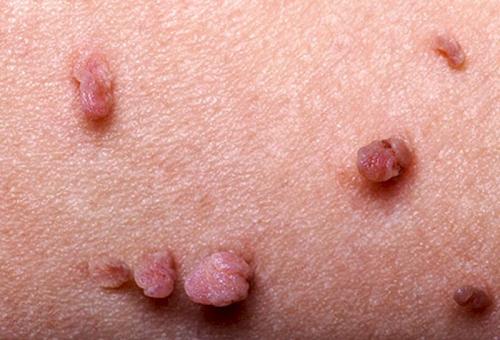 Возрастная кожа. возрастные изменения и 15 болезней кожи