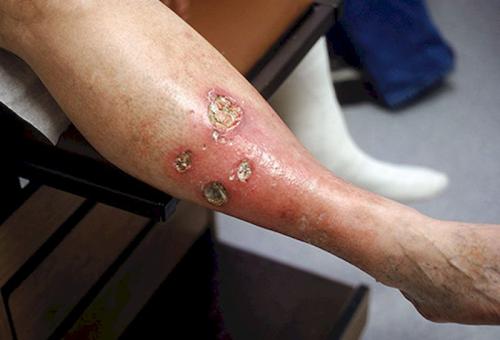 Возрастная кожа. возрастные изменения и 15 болезней кожи