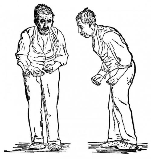 Лечение заболеваний кожи NitaFarm Ивермек 1%. Инструкция по применению лекарственного препарата Ивермек-гель 01 Лечение заболеваний кожи NitaFarm Ивермек 1%. Инструкция по применению лекарственного препарата Ивермек-гель 01