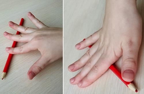 Лфк для пальцев рук. 14 упражнений для пальцев рук при артрозе и артрите