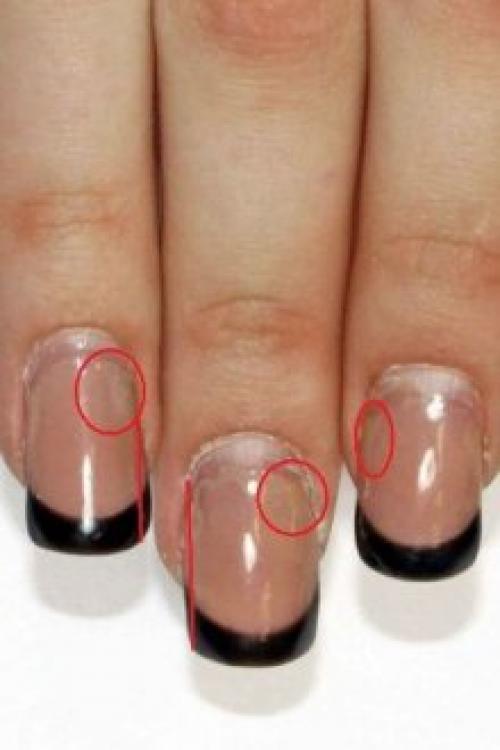 Если отслаивается гель, что делать если. Почему отслаивается гель-лак от ногтей: причины и особенности