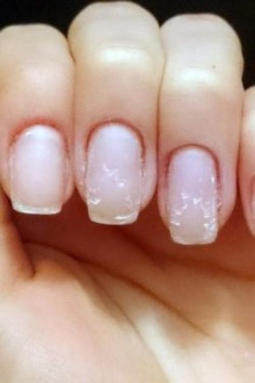 Если отслаивается гель, что делать если. Почему отслаивается гель-лак от ногтей: причины и особенности