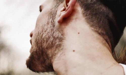 Родинки на шее значение. Что означают родинки на шее