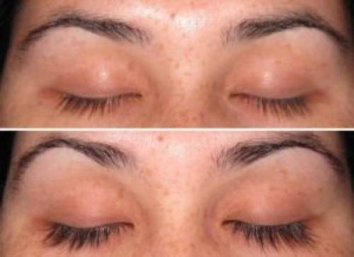 Для ресниц касторовое или репейное масло. Касторовое или репейное масло: какое лучше для укрепления ресниц и бровей 09