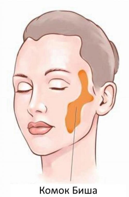 Комки Биша у звезд. Звезды, удалившие комки Биша: стоила ли игра свеч? (21 фото) 14 Комки Биша у звезд. Звезды, удалившие комки Биша: стоила ли игра свеч? (21 фото) 14