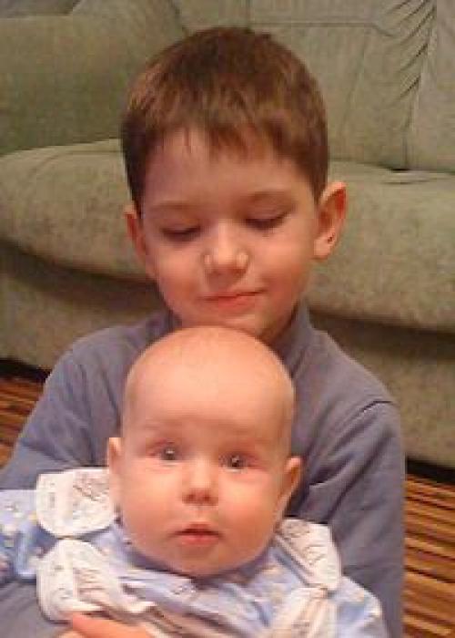 Комки Биша у звезд. Звезды, удалившие комки Биша: стоила ли игра свеч? (21 фото) 16 Комки Биша у звезд. Звезды, удалившие комки Биша: стоила ли игра свеч? (21 фото) 16