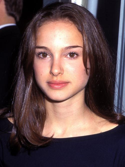 Комки Биша у звезд. Звезды, удалившие комки Биша: стоила ли игра свеч? (21 фото) 10 Комки Биша у звезд. Звезды, удалившие комки Биша: стоила ли игра свеч? (21 фото) 10