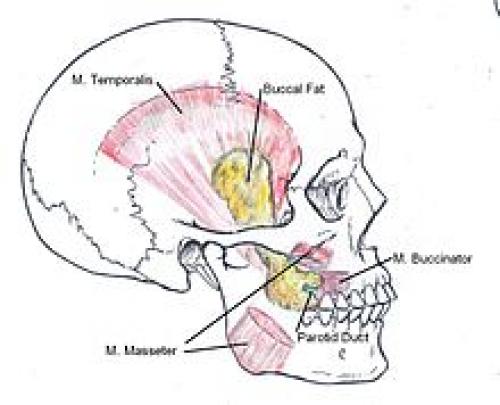 Комки Биша у звезд. Звезды, удалившие комки Биша: стоила ли игра свеч? (21 фото) 15 Комки Биша у звезд. Звезды, удалившие комки Биша: стоила ли игра свеч? (21 фото) 15