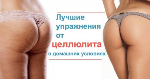Как избавиться от целлюлита на попе. 5 лучших упражнений, чтобы избавиться от целлюлита на бедрах, ногах и ягодицах