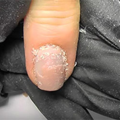 Чем снять лак-гель. Как снять лак-гель без специальной жидкости