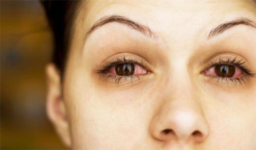 Касторовое масло для ресниц сколько держать. Правила использования