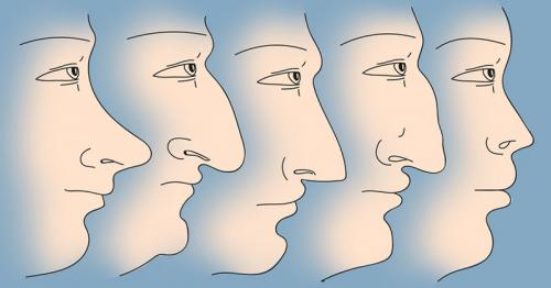 Какие болезни отражаются на лице. Диагностирование болезней по лицу человека 01 Какие болезни отражаются на лице. Диагностирование болезней по лицу человека 01