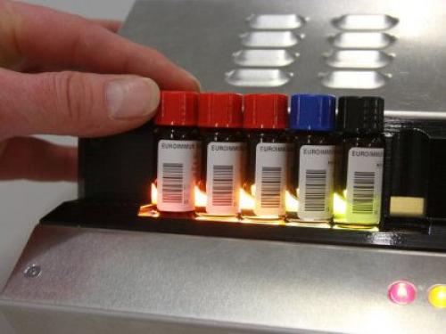 Какие анализы на гормоны нужно сдать женщине после 50 лет. 7 анализов крови, которые должны сдать все люди старше 50