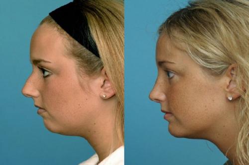 Какие люди считаются красивыми. Красота в понятии каждого человека весьма субъективна. Какой-то общеизвестной формулы красоты в природе нет. Хотя определённые показатели, по которым человека можно назвать красивым, существуют.