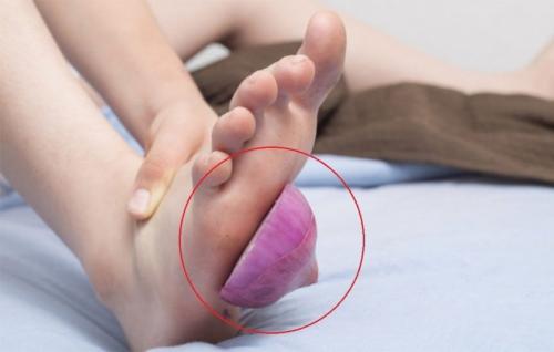 Интересные факты о зачем нужно спать с луком в носках. 10 невероятно полезных причин, почему стоит класть лук в носки перед сном