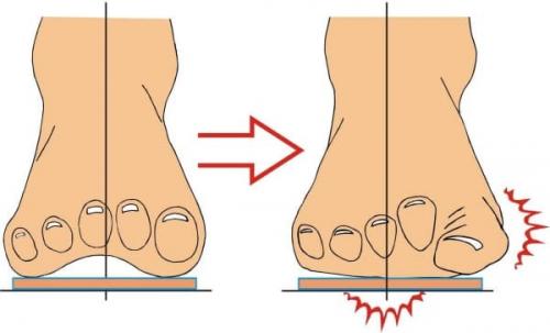 Что делать, если обувь давит на пятку. Вред обуви на низком ходу