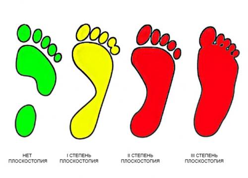 Что делать, если обувь давит на пятку. Вред обуви на низком ходу