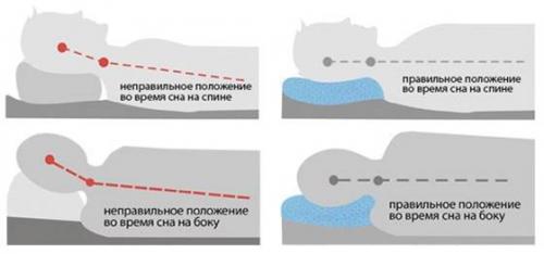 Полезно ли спать без подушки. Сон без подушки. Плюсы и минусы 07 Полезно ли спать без подушки. Сон без подушки. Плюсы и минусы 07