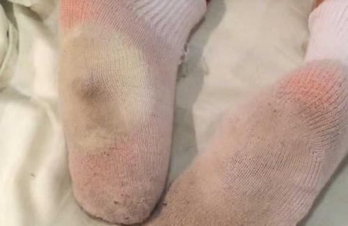 Интересные факты о зачем надо спать с луком в носках. Бабушка рассказала мне, зачем класть лук на ночь в носки. Теперь и я так делаю 03