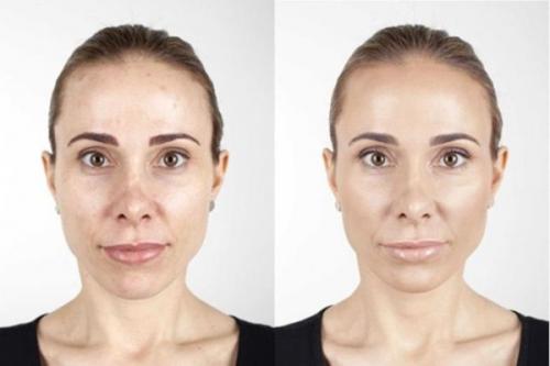 Как сделать кожу лица идеальной? 02