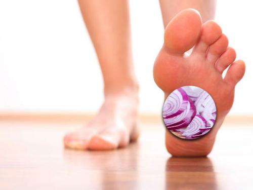 Как правильно класть лук в носки. Как лук в носках способен избавить от грибка и простуды