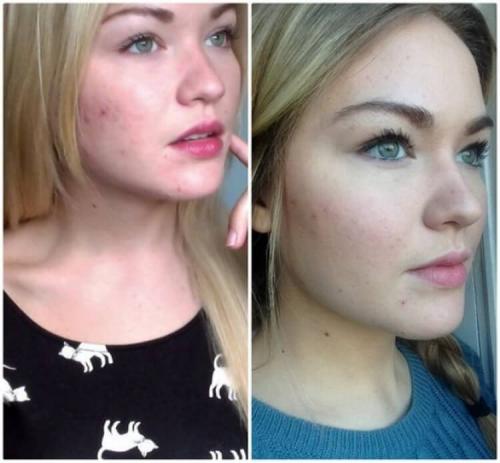 10 хитростей по уходу за собой