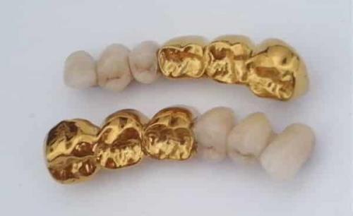 Чего боится медицинское золото. Применение и свойства изделий из медицинского золота