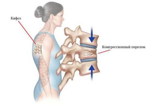 Не хочу мыться и вцелом следить за собой. Не хочу ухаживать за собой. 02 Не хочу мыться и вцелом следить за собой. Не хочу ухаживать за собой. 02