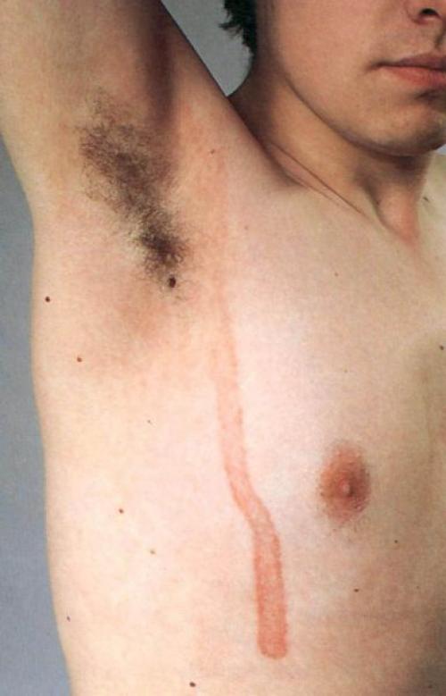 Как избавиться от пигментных пятен. Почему появляются пигментные пятна 06