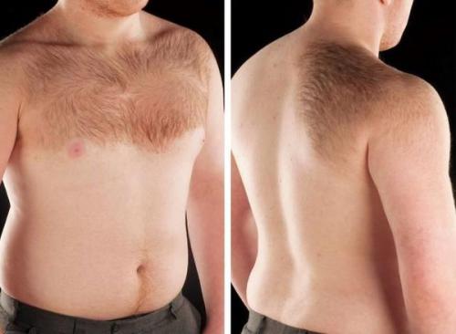 Как избавиться от пигментных пятен. Почему появляются пигментные пятна 04