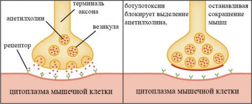 Уход за кожей после 30 лет в салоне красоты Фрезия. Дряблая кожа 12