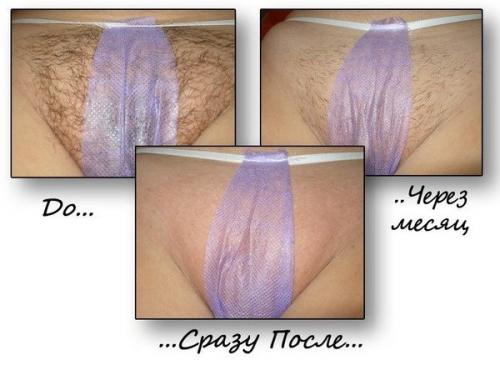 9 ошибок при проведении шугаринга. Слово мастера: самые частые ошибки клиентов до и после шугаринга 14