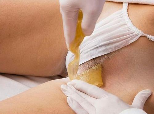 Вросший волос в паху. Вросшие волосы в паху