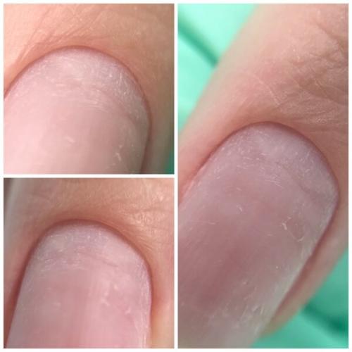 Нужно ли перед наращиванием наносить базу. Этапы наращивания ногтей гелем 02 Нужно ли перед наращиванием наносить базу. Этапы наращивания ногтей гелем 02