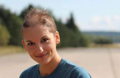 Как остановить выпадение волос после химиотерапии. Выпадение волос после химиотерапии 01 Как остановить выпадение волос после химиотерапии. Выпадение волос после химиотерапии 01