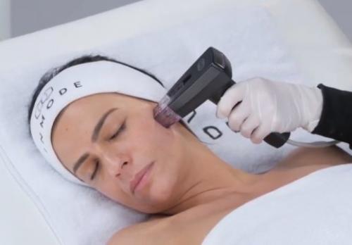 RF-лифтинг лица и тела цена от 4500 руб.. Как проходит процедура RF лифтинга кожи 04