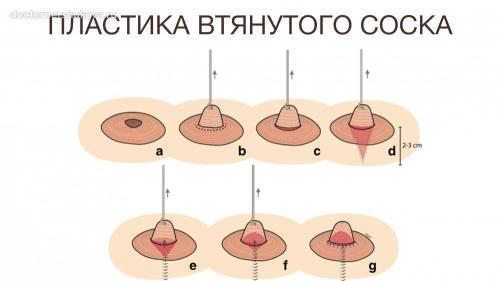 Как улучшить форму и поднять соски: практические советы и упражнения 06
