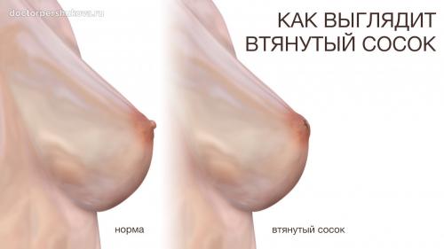 Как улучшить форму и поднять соски: практические советы и упражнения 07