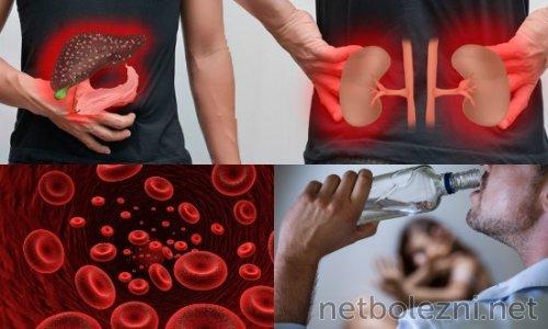 Лечение коронавируса: возможно ли профилактика и лечение с помощью лекарств 02 Лечение коронавируса: возможно ли профилактика и лечение с помощью лекарств 02