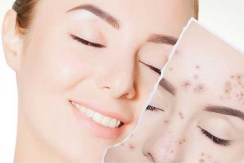 10 советов для идеальной кожи лица: как улучшить внешний вид своего лица 02