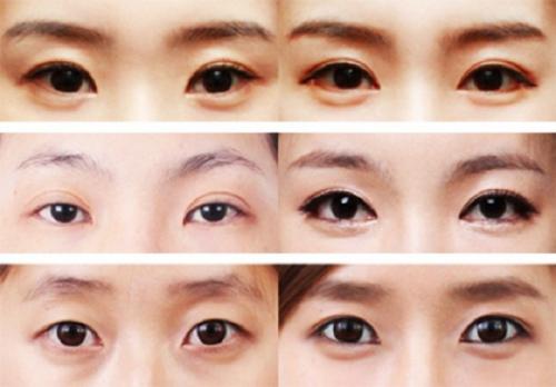 Как увеличить глаза азиатского типа. Особенности азиатских глаз