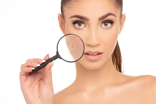 Прыщики на лице о чем говорят. О чем говорят прыщи на лице 01