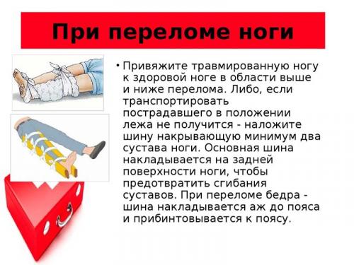 2+ Бесплатные уход за Больными  Перелом изображения. Первая помощь при переломах